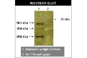 Western blot using RYK antibody   on HCT116 cell lysates. (TXK Antikörper)