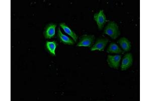 Immunofluorescent analysis of A549 cells using ABIN7142496 at dilution of 1:100 and Alexa Fluor 488-congugated AffiniPure Goat Anti-Rabbit IgG(H+L) (RPS15 Antikörper  (AA 63-137))