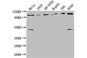 Western Blot Positive WB detected in: Hela whole cell lysate, 293T whole cell lysate, SH-SY5Y whole cell lysate, HepG2 whole cell lysate, 293 whole cell lysate, A549 whole cell lysate All lanes: RABEP1 antibody at 1:2500 Secondary Goat polyclonal to rabbit IgG at 1/50000 dilution Predicted band size: 100, 96 kDa Observed band size: 100 kDa