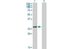Western Blot analysis of TK1 expression in transfected 293T cell line by TK1 MaxPab polyclonal antibody. (TK1 Antikörper  (AA 1-234))