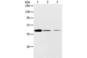 Western Blot analysis of NIH/3T3 and SKOV3 cell, Human ovarian cancer tissue using ABCE1 Polyclonal Antibody at dilution of 1:450