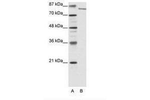 Image no. 2 for anti-Lysine (K)-Specific Demethylase 2A (KDM2A) (N-Term) antibody (ABIN6736177) (KDM2A Antikörper  (N-Term))