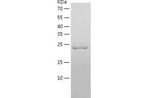 Western Blotting (WB) image for Crystallin, beta A4 (CRYbA4) (AA 1-196) protein (His tag) (ABIN7122502)