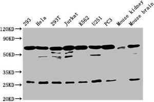 Western Blot Positive WB detected in: 293 whole cell lysate, Hela whole cell lysate, 293T whole cell lysate, Jurkat whole cell lysate, K562 whole cell lysate, U251 whole cell lysate, PC-3 whole cell lysate, Mouse kidney tissue, Mouse brain tissue All lanes: ARIH2 antibody at 1:2000 Secondary Goat polyclonal to rabbit IgG at 1/50000 dilution Predicted band size: 58 kDa Observed band size: 68 kDa (ARIH2 Antikörper  (AA 43-360))