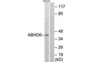 Western blot analysis of extracts from COLO cells, using ABHD6 Antibody. (ABHD6 Antikörper  (AA 231-280))