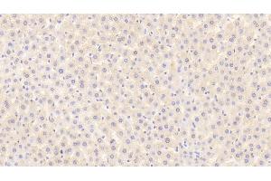 Detection of MSP in Rat Liver Tissue using Polyclonal Antibody to Macrophage Stimulating Protein (MSP) (MST1 Antikörper  (AA 489-716))