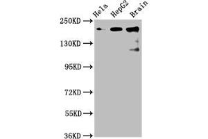 Western Blot Positive WB detected in: Hela whole cell lysate, HepG2 whole cell lysate, Rat brain tissue All lanes: CKAP5 antibody at 6 μg/mL Secondary Goat polyclonal to rabbit IgG at 1/50000 dilution Predicted band size: 226, 219, 227 kDa Observed band size: 226 kDa (CKAP5 Antikörper  (AA 1802-2019))