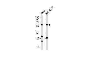 Western blot analysis of lysates from Hela,SH-SY5Y cell line (from left to right),using CALR Antibody (ABIN484301 and ABIN1533682). (Calreticulin Antikörper)