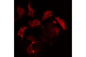 ABIN6274963 staining HepG2  cells by IF/ICC. (CA6 Antikörper  (C-Term))