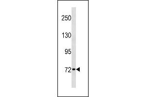 SYN1 Antibody (C-term) (ABIN1881860 and ABIN2843335) western blot analysis in HL-60 cell line lysates (35 μg/lane). (SYN1 Antikörper  (C-Term))