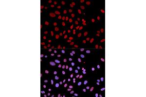Immunofluorescence analysis of U2OS cells using PTPN6 antibody (ABIN5970673). (SHP1 Antikörper)