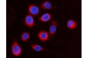 IF analysis of ARFGAP1 using anti-ARFGAP1 antibody (ABIN4886474).