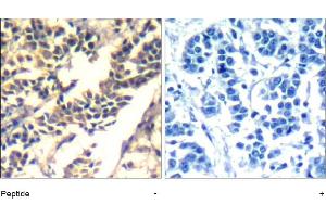 Image no. 1 for anti-Cas-Br-M (Murine) Ecotropic Retroviral Transforming Sequence (CBL) (Tyr700) antibody (ABIN401654) (CBL Antikörper  (Tyr700))