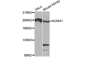 Western blot analysis of extracts of various cell lines, using NUMA1 antibody. (NUMA1 Antikörper)