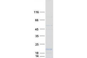 Validation with Western Blot