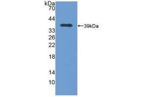 Western blot analysis of recombinant Human MT2. (MT2 Antikörper  (AA 2-61))