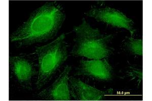 Immunofluorescence (IF) image for anti-ATP-Binding Cassette, Sub-Family F (GCN20), Member 1 (ABCF1) (AA 642-739) antibody (ABIN513037)