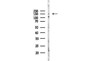 anti-ATP-Binding Cassette, Sub-Family C (CFTR/MRP), Member 11 (ABCC11) (Internal Region) antibody