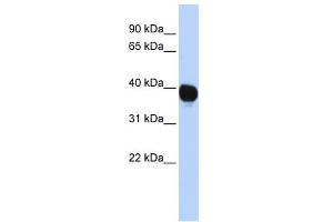 WB Suggested Anti-TPST2 Antibody Titration:  0. (TPST2 Antikörper  (Middle Region))