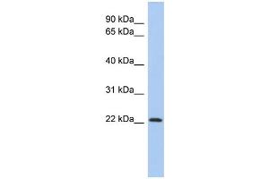 WB Suggested Anti-ZNF833P Antibody Titration:  0. (LOC401898 Antikörper  (N-Term))