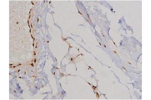 Immunohistochemistry (IHC) image for anti-PTK2 Protein tyrosine Kinase 2 (PTK2) (pTyr397) antibody (ABIN6256730)