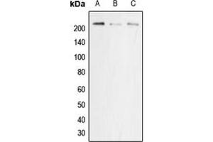 Western blot analysis of p22 phox expression in MCF7 (A), NIH3T3 (B), PC12 (C) whole cell lysates. (CYBA Antikörper  (Center))