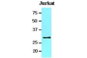 Cell lysates of Jurkat (20 ug) were resolved by SDS-PAGE, transferred to nitrocellulose membrane and probed with anti-human 14-3-3 tau (1:1000). (14-3-3 theta Antikörper  (AA 1-245))