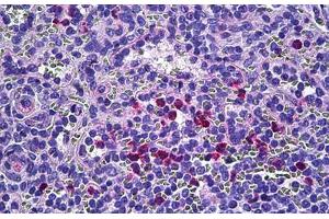 Human Spleen: Formalin-Fixed, Paraffin-Embedded (FFPE) (Retinol Binding Protein 5 Antikörper  (AA 10-59))