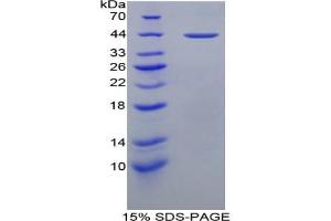 SDS-PAGE of Protein Standard from the Kit (Highly purified E. (Major Basic Protein ELISA Kit)