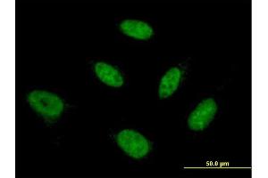 Immunofluorescence of monoclonal antibody to NFYB on HeLa cell. (NFYB Antikörper  (AA 1-207))