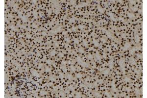 ABIN6278676 at 1/100 staining Mouse kidney tissue by IHC-P. (PITX3 Antikörper)
