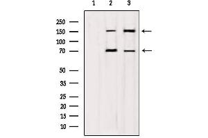 Western blot analysis of extracts from various samples, using mDia1 Antibody. (DIAPH1 Antikörper)