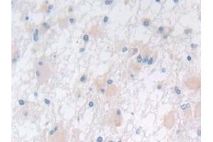 Immunohistochemistry (IHC) image for anti-Acid Phosphatase, Prostate (ACPP) (AA 217-386) antibody (ABIN7431248)
