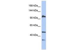 Image no. 1 for anti-XPA Binding Protein 2 (XAB2) (AA 35-84) antibody (ABIN6743564) (XAB2 Antikörper  (AA 35-84))