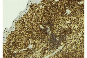ABIN6277498 at 1/100 staining Mouse pancreas tissue by IHC-P.