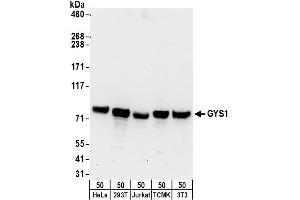 Western Blotting (WB) image for anti-Glycogen Synthase 1 (Muscle) (GYS1) (AA 625-675) antibody (ABIN7450309)