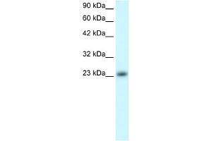WB Suggested Anti-MXD4 Antibody Titration:  0. (MXD4 Antikörper  (N-Term))