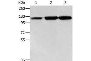 Western Blot analysis of PC3 cell, Human colon cancer and liver cancer tissue using HSP105 Polyclonal Antibody at dilution of 1:500 (HSPH1 Antikörper)