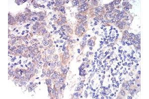 Immunohistochemistry (IHC) image for anti-Aldehyde Dehydrogenase 6 Family, Member A1 (ALDH6A1) (AA 1-195) antibody (ABIN5856297) (ALDH6A1 Antikörper  (AA 1-195))