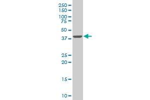 SMARCB1 monoclonal antibody (M03), clone 3C4 Western Blot analysis of SMARCB1 expression in Hela S3 NE . (SMARCB1 Antikörper  (AA 81-180))