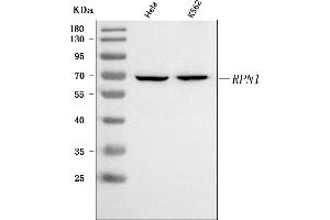 Western blot analysis of RPN1 using anti-RPN1 antibody (ABIN7600447).