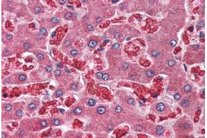 Human Liver (formalin-fixed, paraffin-embedded) stained with A2M antibody ABIN396916 at 10 ug/ml followed by biotinylated goat anti-rabbit IgG secondary antibody ABIN481713, alkaline phosphatase-streptavidin and chromogen.