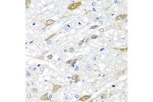 Immunohistochemistry of paraffin-embedded rat brain using CP antibody (ABIN6129673, ABIN6138930, ABIN6138932 and ABIN6217722) at dilution of 1:100 (40x lens). (CPA6 Antikörper  (AA 130-437))