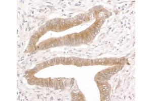Immunohistochemistry (IHC) image for anti-Reticulocalbin 1, EF-Hand Calcium Binding Domain (RCN1) (AA 1-75) antibody (ABIN7453447) (RCN1 Antikörper  (AA 1-75))