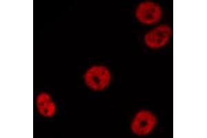 Immunofluorescence (fixed cells) (IF/ICC) image for anti-Histone Deacetylase 5 (HDAC5) (C-Term) antibody (ABIN6262182)