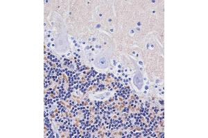ABIN653897 staining H in human cerebellum tissue sections by Immunohistochemistry (IHC-P - paraformaldehyde-fixed, paraffin-embedded sections). (AMH Antikörper  (AA 424-451))