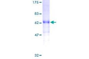 VEGFD Protein (AA 1-354) (GST tag)