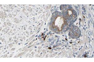 ABIN6277164 at 1/100 staining Human prostate tissue by IHC-P. (Phospholipase C gamma 2 Antikörper  (Internal Region))