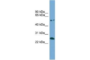 WB Suggested Anti-ETHE1  Antibody Titration: 0. (ETHE1 Antikörper  (Middle Region))