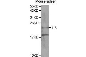 Western blot analysis of extracts of mouse spleen tissue, using IL6 antibody. (IL-6 Antikörper)